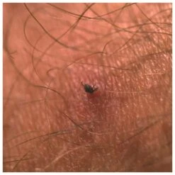 Tire-tique Lifesystems Tick Card White 7 Tire-tique Lifesystems Tick Card White -Camping En Plein Air 5caa9b000328b9fce2cba62ee690e4a28e83c865 E23LIFSBIV381147 LIFS0202195 901